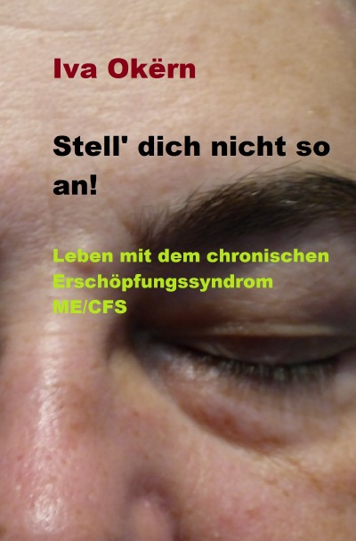'Stell dich nicht so an! Leben mit dem chronischen Erschöpfungssyndrom ME /CFS'-Cover