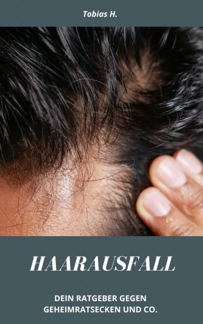 'Cover von Haarausfall – dein Ratgeber gegen Geheimratsecken und Co.'-Cover