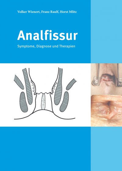 'Cover von Analfissur'-Cover