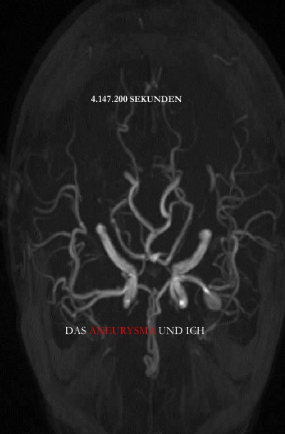 'Cover von 4.147.200 Sekunden – Das Aneurysma und ich'-Cover