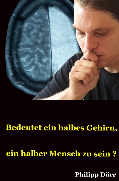 'Bedeutet ein halbes Gehirn, ein halber Mensch zu sein?'-Cover
