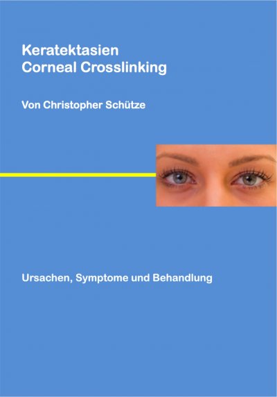 'Keratektasien'-Cover