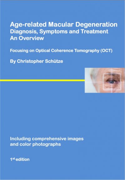 'Age-related macular degeneration'-Cover