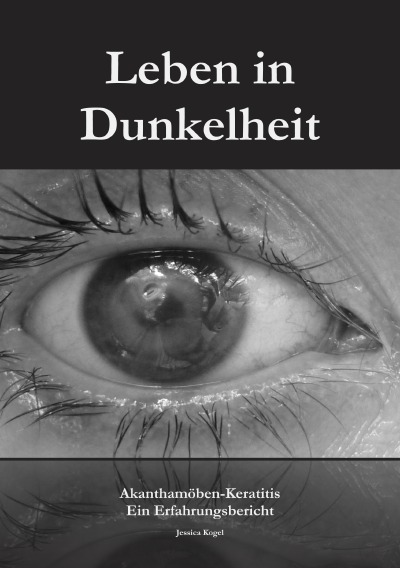 'Leben in Dunkelheit – Akanthamöben-Keratitis'-Cover
