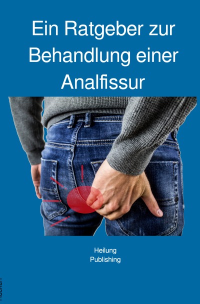 'Ein Ratgeber zur Behandlung einer Analfissur'-Cover